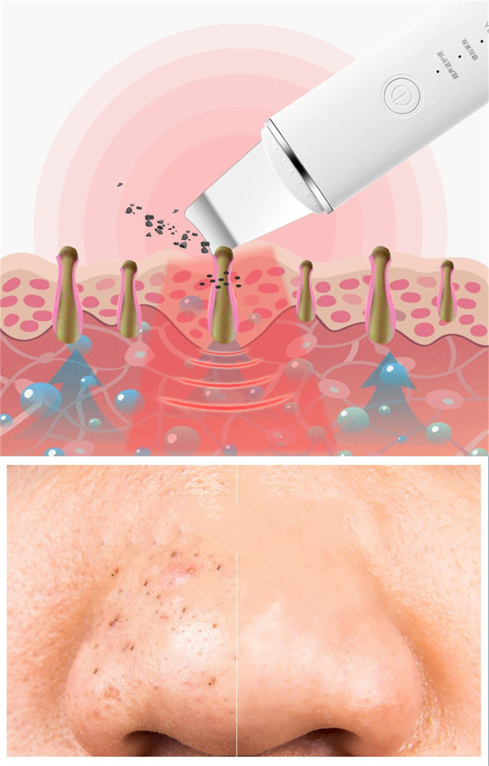 Illustration of a skin treatment device with close-up of skin texture.